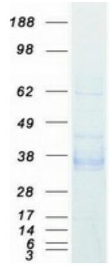 Coomassie blue staining of purified EPCAM protein.